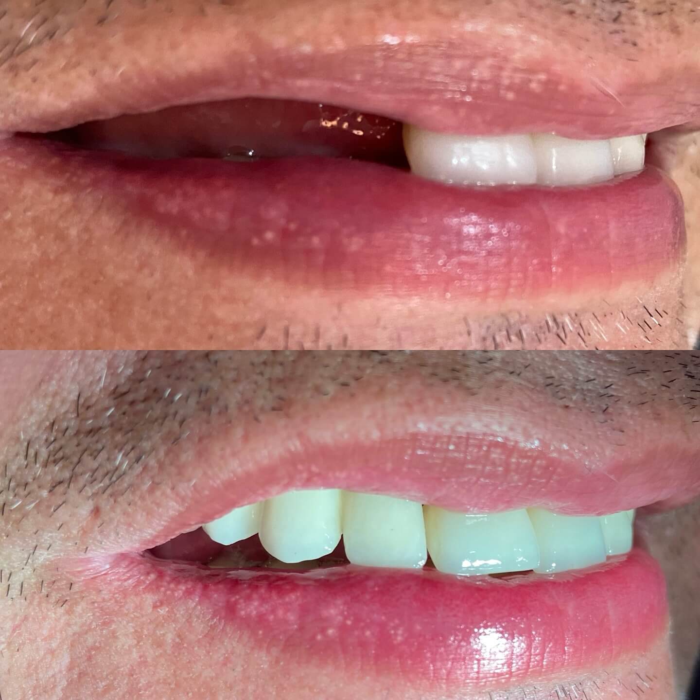 Registro fotográfico de caso clínico 1 enviado pela Odontoclínica