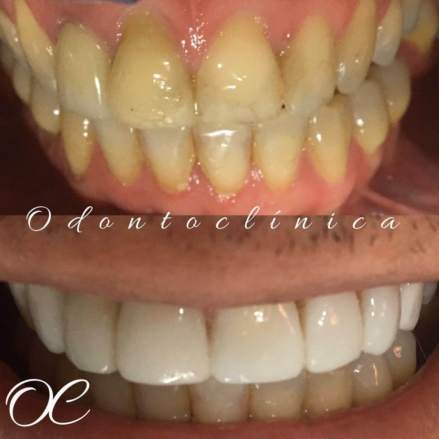 Registro fotográfico de caso clínico 3 enviado pela Odontoclínica